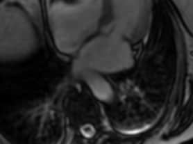 Image A