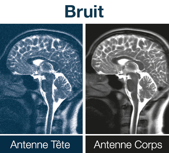 Bruit