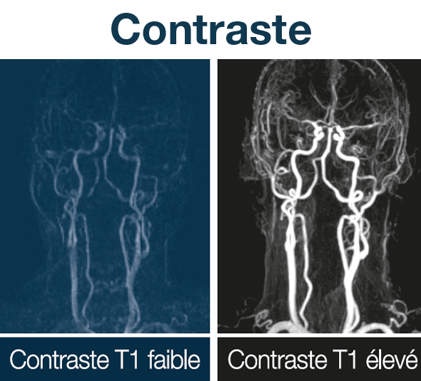 Contraste
