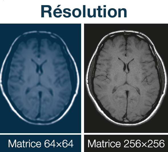 Résolution