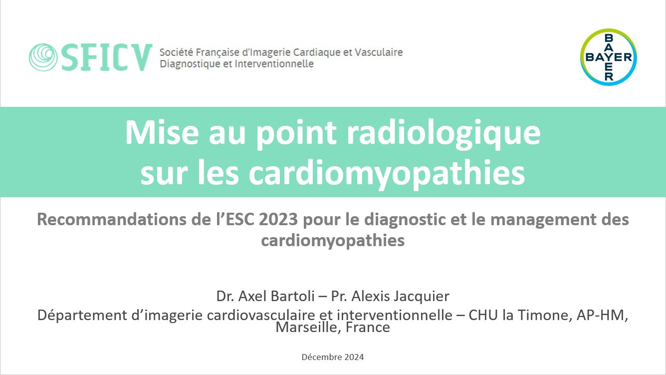 Mise au point radiologique sur les cardiomyopathies